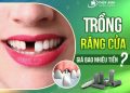 Trồng răng cửa bao nhiêu tiền? Tìm địa chỉ trồng răng uy tín 
